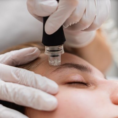 Close-up of a person receiving a microdermabrasion treatment on the forehead, performed by a professional with gloves.