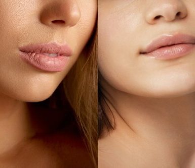 Collage of four different lip shapes, showcasing a variety of natural lip styles for a blog post on types of lip shapes.