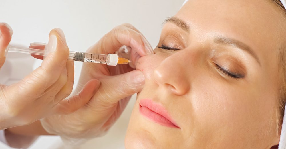 A woman receiving a cheek filler injection as part of a cosmetic treatment.