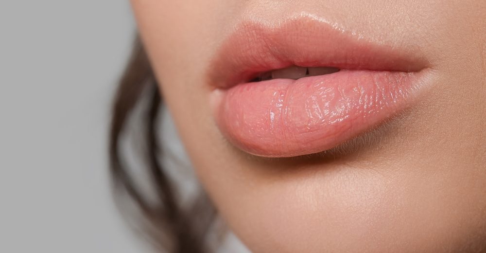 Close-up of smooth, plump lips showcasing the results of a lip filler treatment.