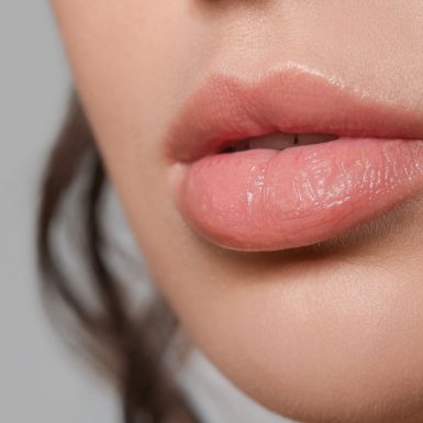 Close-up of smooth, plump lips showcasing the results of a lip filler treatment.